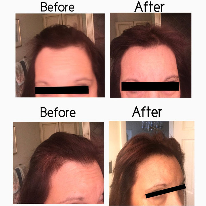 Hair Strengthening Serum - All Natural, Vegan, Hair loss, Dry/Itchy Scalp