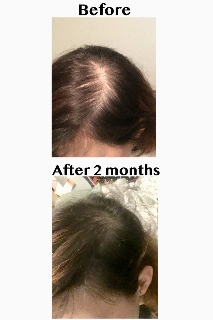 Hair Strengthening Serum - All Natural, Vegan, Hair loss, Dry/Itchy Scalp