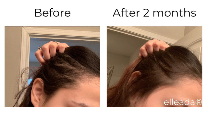 Hair Strengthening Serum - All Natural, Vegan, Hair loss, Dry/Itchy Scalp