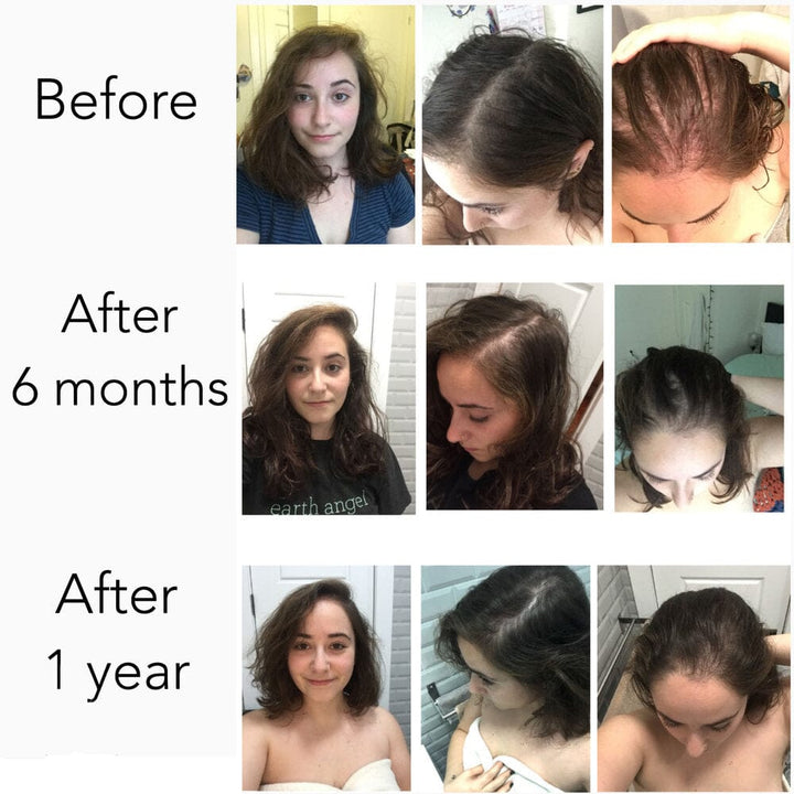 Hair Strengthening Serum - All Natural, Vegan, Hair loss, Dry/Itchy Scalp