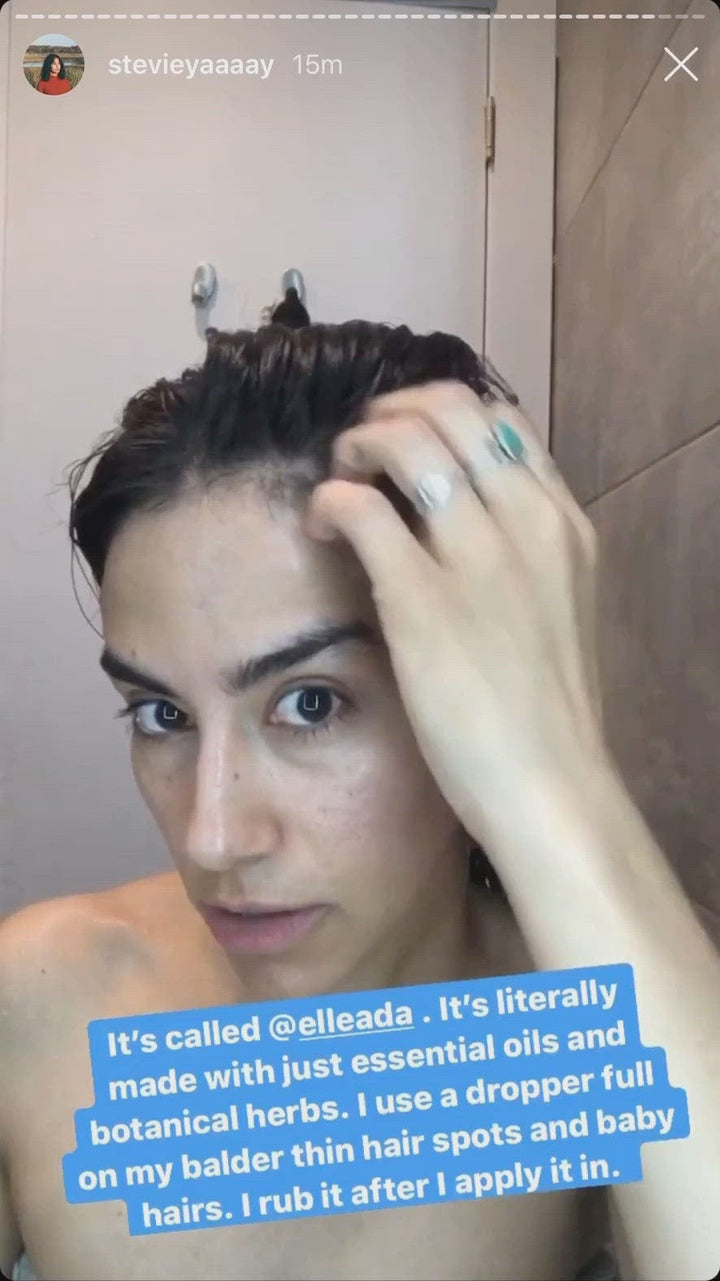 Hair Strengthening Serum - All Natural, Vegan, Hair loss, Dry/Itchy Scalp