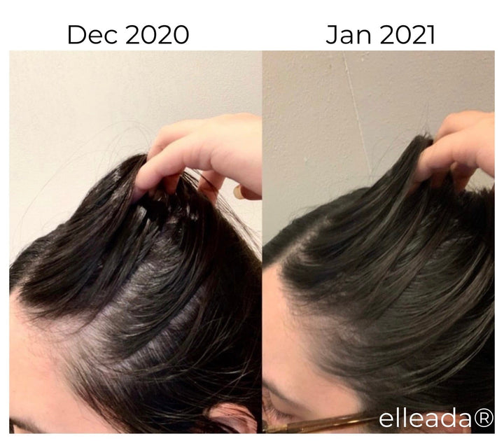 Hair Strengthening Serum - All Natural, Vegan, Hair loss, Dry/Itchy Scalp