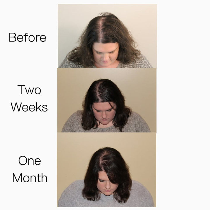 Hair Strengthening Serum - All Natural, Vegan, Hair loss, Dry/Itchy Scalp