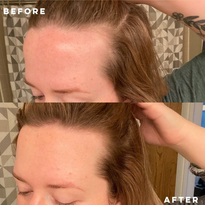 Hair Strengthening Serum - All Natural, Vegan, Hair loss, Dry/Itchy Scalp