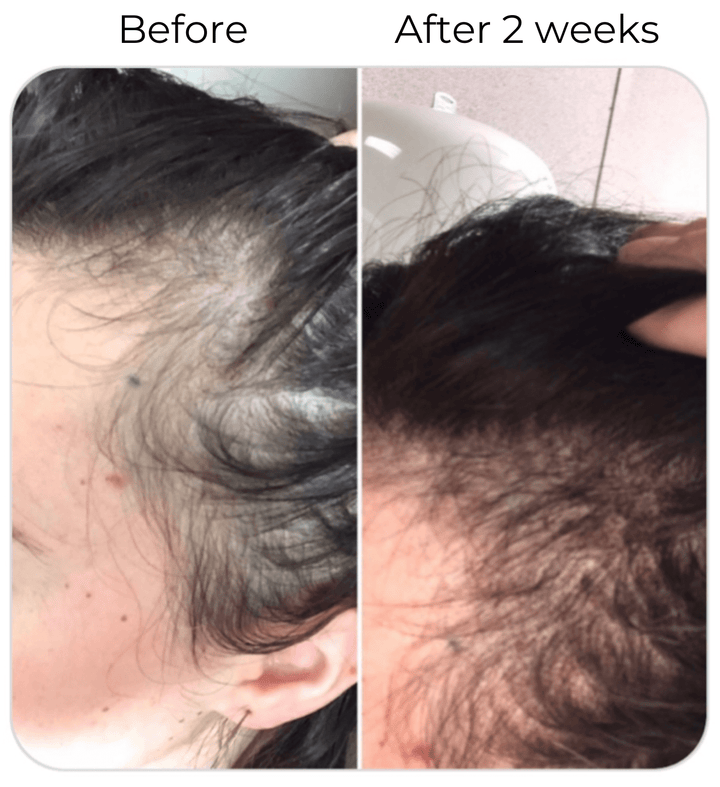 Hair Strengthening Serum - All Natural, Vegan, Hair loss, Dry/Itchy Scalp