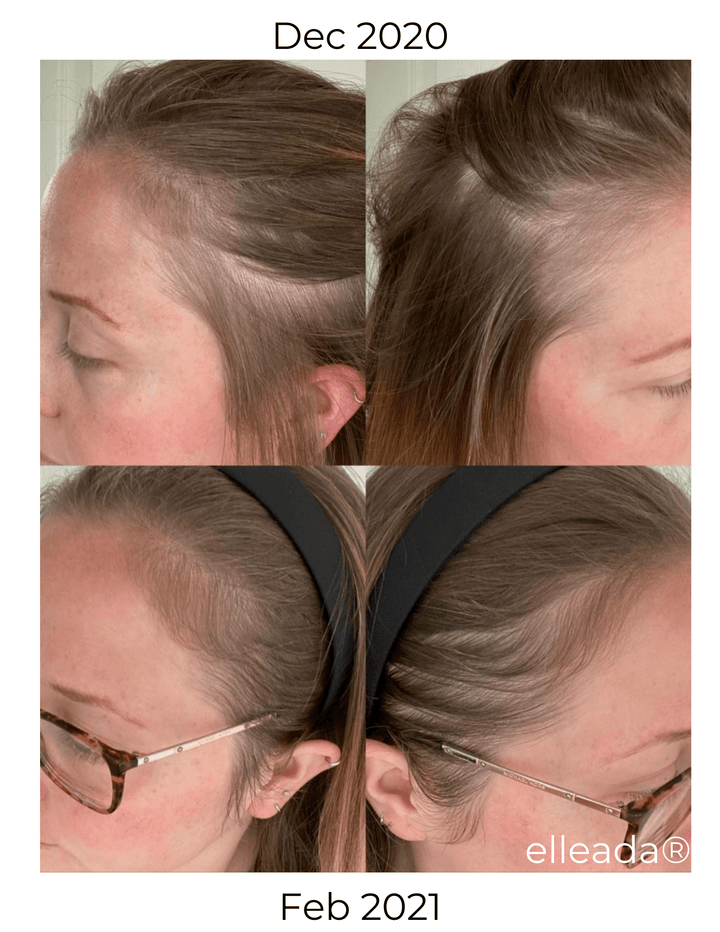 Hair Strengthening Serum - All Natural, Vegan, Hair loss, Dry/Itchy Scalp