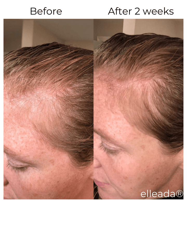 Hair Strengthening Serum - All Natural, Vegan, Hair loss, Dry/Itchy Scalp