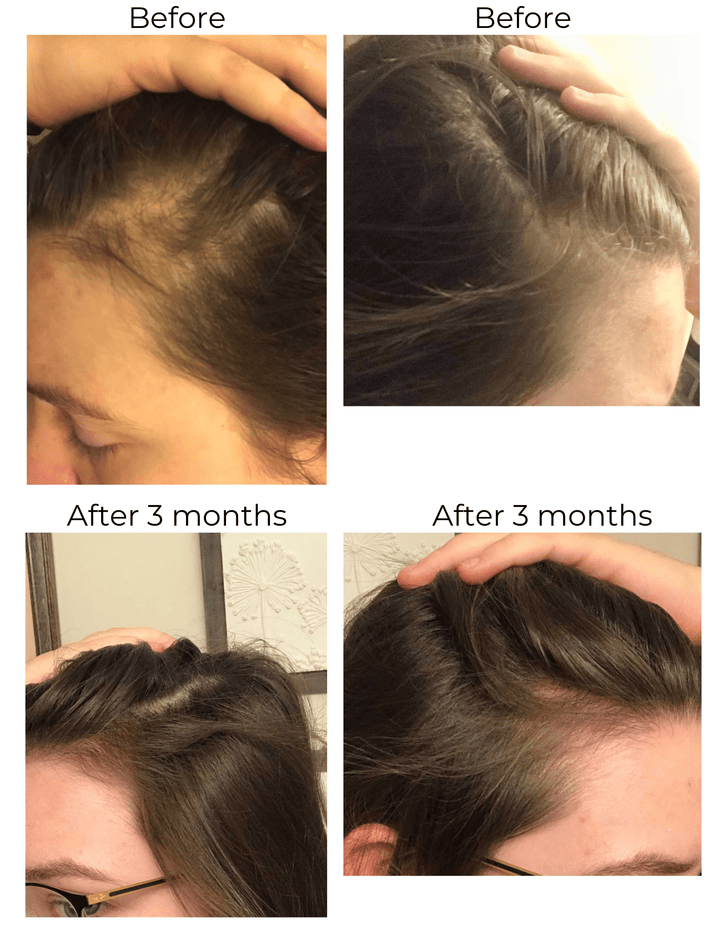 Hair Strengthening Serum - All Natural, Vegan, Hair loss, Dry/Itchy Scalp