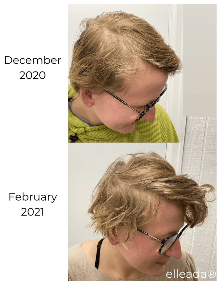 Hair Strengthening Serum - All Natural, Vegan, Hair loss, Dry/Itchy Scalp