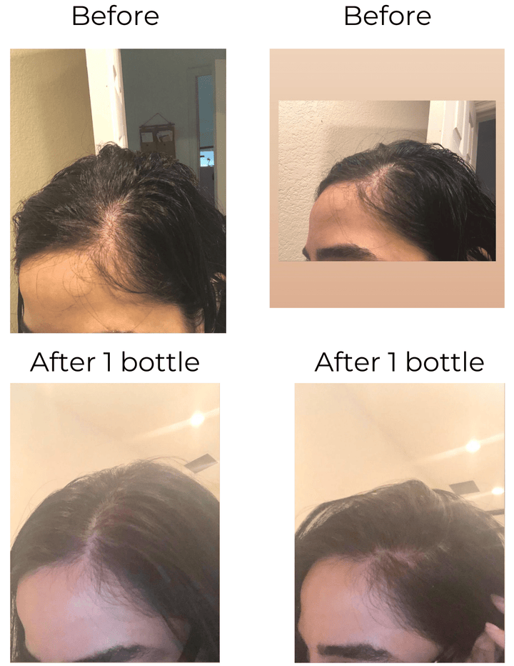 Hair Strengthening Serum - All Natural, Vegan, Hair loss, Dry/Itchy Scalp