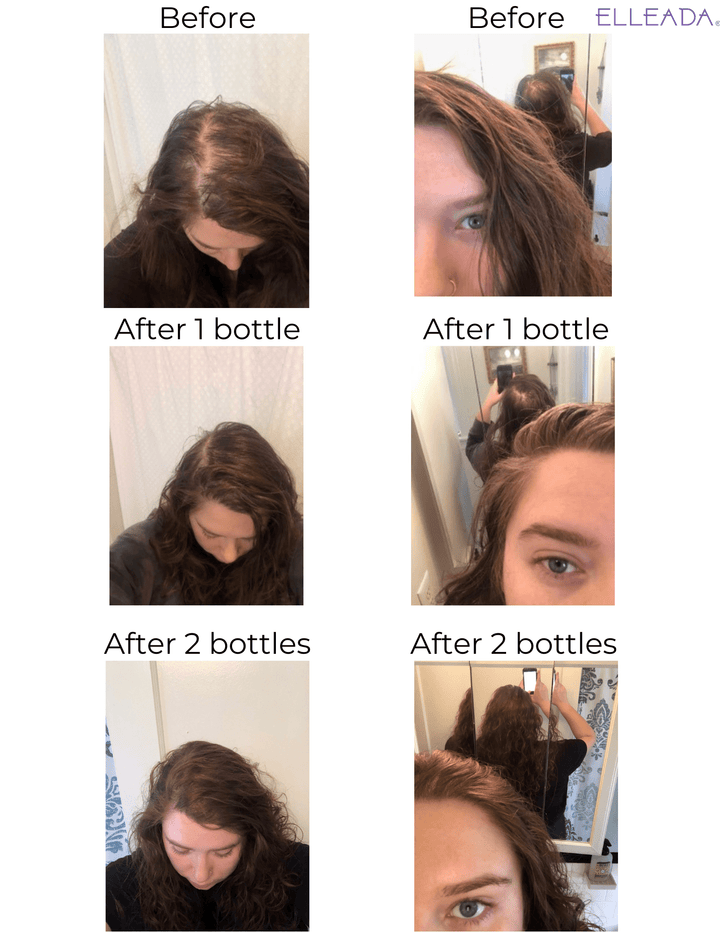 Hair Strengthening Serum - All Natural, Vegan, Hair loss, Dry/Itchy Scalp