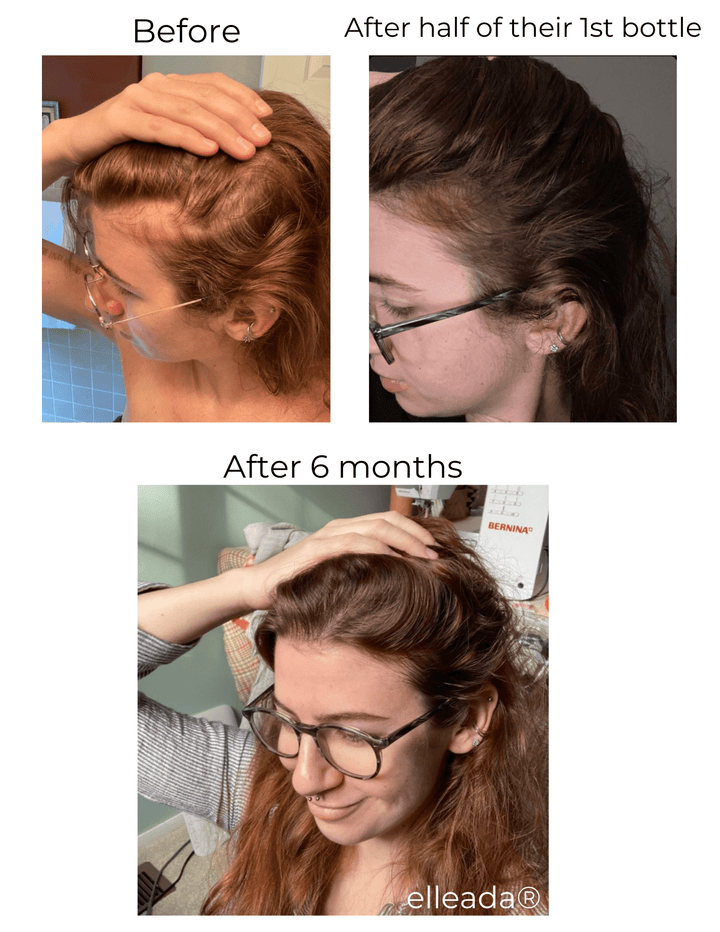 Hair Strengthening Serum - All Natural, Vegan, Hair loss, Dry/Itchy Scalp