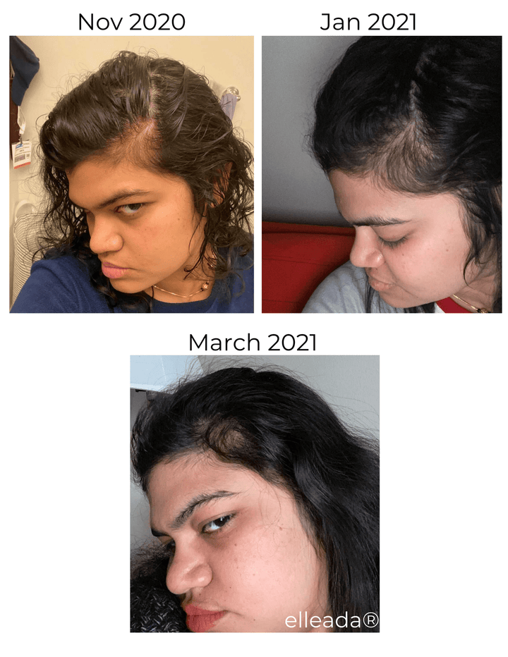 Hair Strengthening Serum - All Natural, Vegan, Hair loss, Dry/Itchy Scalp